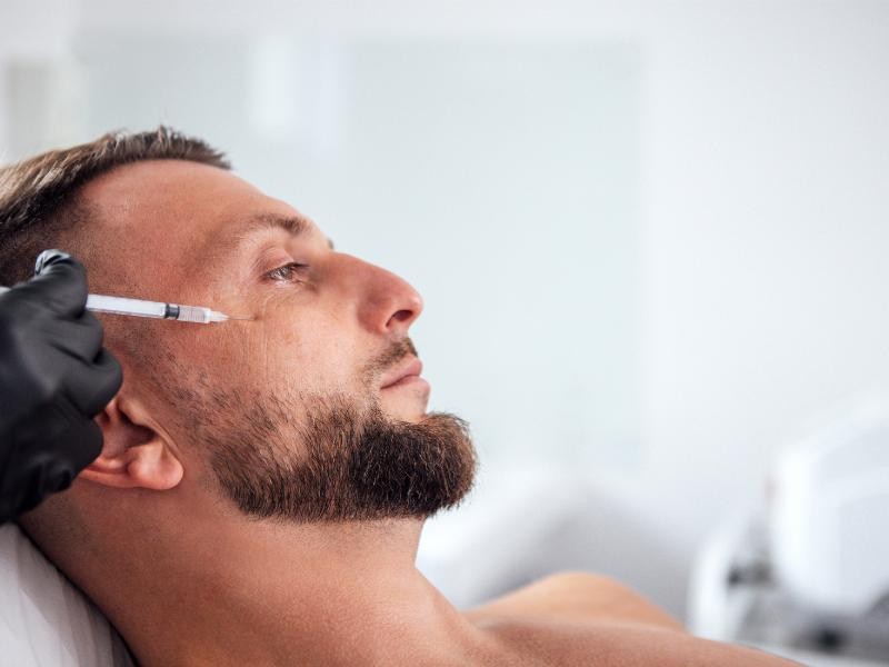 👨‍⚕️ Botox Masculino: Tudo o Que os Homens Precisam Saber Antes de Fazer Introdução