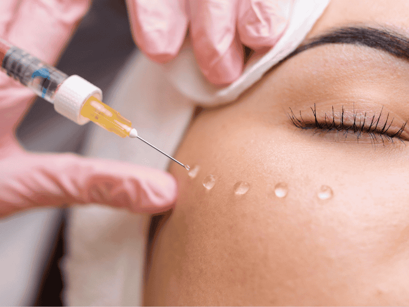 Como prevenir o envelhecimento com o bioestimulador de colágeno — segurança e resultados com a Clínica Magrass