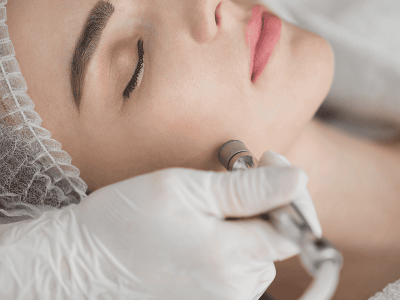 Peeling de Diamante