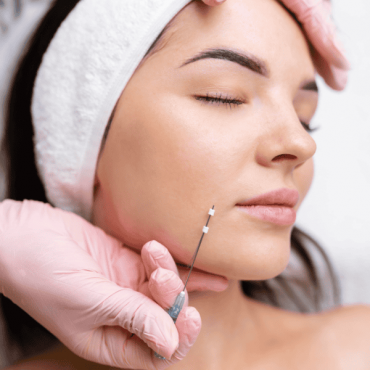 Fios de PDO em Barão do Triunfo