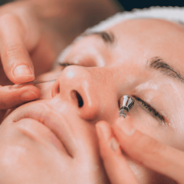 Tratamento para Olheiras em Barão do Triunfo