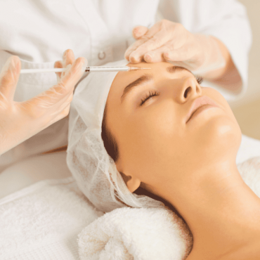 Preenchedores com Ácido Hialurônico em Barão do Triunfo