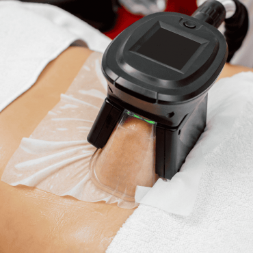 Tratamento para Gordura Localizada em Barão do Triunfo