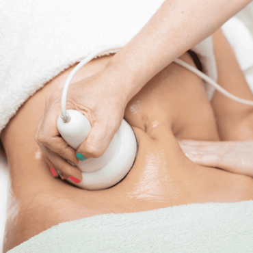 Ultrassom Macrofocado Corporal em Barão do Triunfo