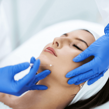 Fios de Sustentação em Barão do Triunfo